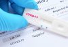 Laboratori privat në Prishtinë kryen ilegalisht testime për koronavirus