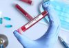 Objekti i ri i Pediatrisë në Mitrovicë do të shfrytëzohet për pacientët me coronavirus